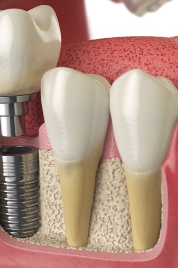 Cirurgia Oral  & Implantologia