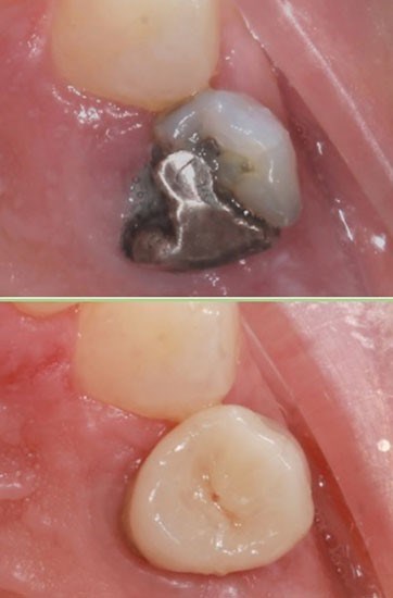 Dentisteria Operatória