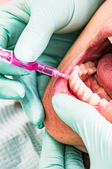 Higiene Oral