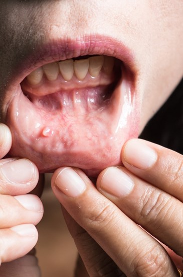 Medicina e Patologia Oral